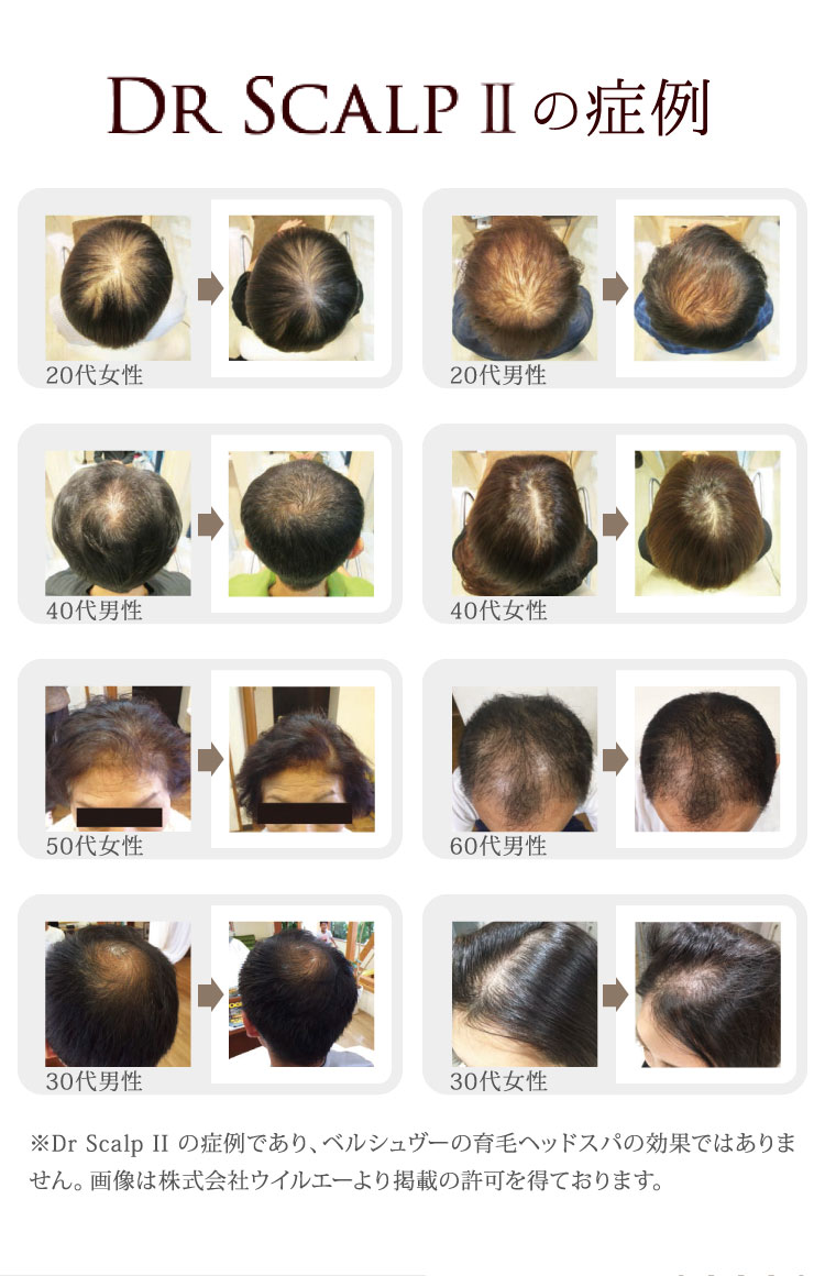Dr Scalp II treatment case examples